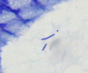 Helicobacter Heilmannii